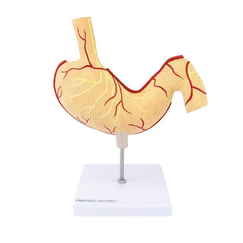 Stomach model with ulcers 