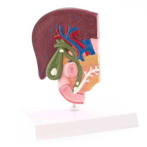 Liver model with gall stones