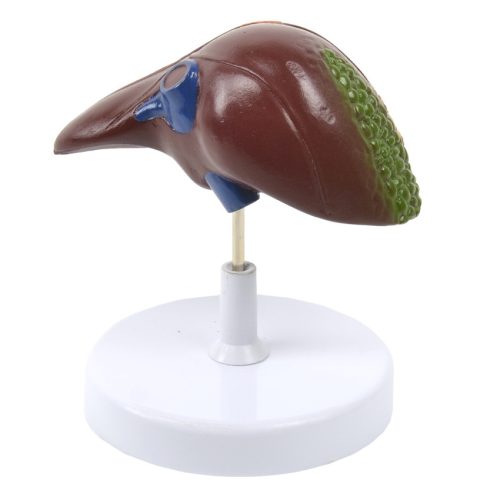 Liver model showing different diseases 