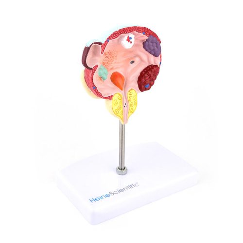 Bladder model with prostate