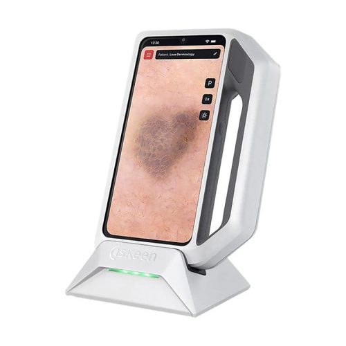 FotoFinder® skeen dermatoscope with AI