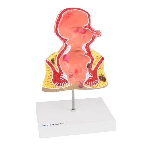 Anatomical rectum model