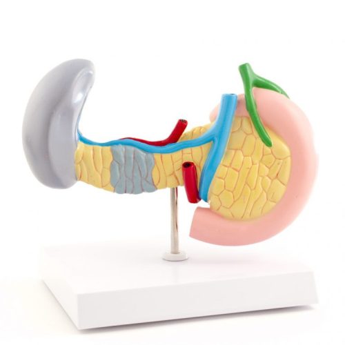 Model of diseased pancreas, spleen and gallbladder