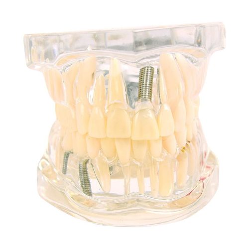 Transparent jaw model | adult teeth