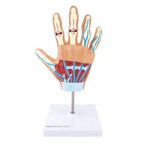 Rheumatoid arthritis model