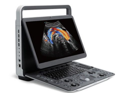 Sonoscape E2V Color Doppler Veterinary Ultrasound System with linear probe L741, convex probe 3C-A, and suitcase