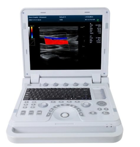 Scanner à ultrasons couleur Portable CMS1700B-VET, système de Diagnost –  CONTEC