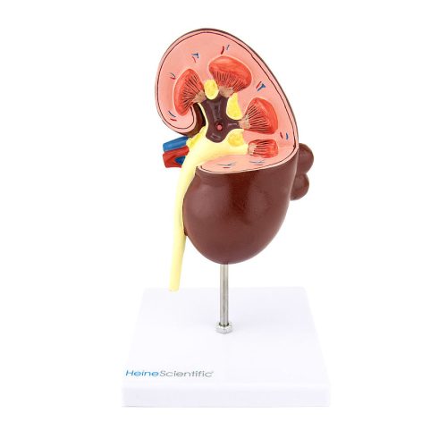 Kidney disease model